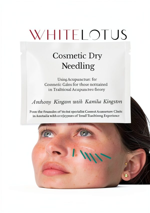 Acupuncture eBook English Kindle Store Enhanced Typesetting-0